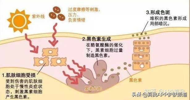 祛痘印效果最佳的产品是什么,祛痘印效果好的产品是什么