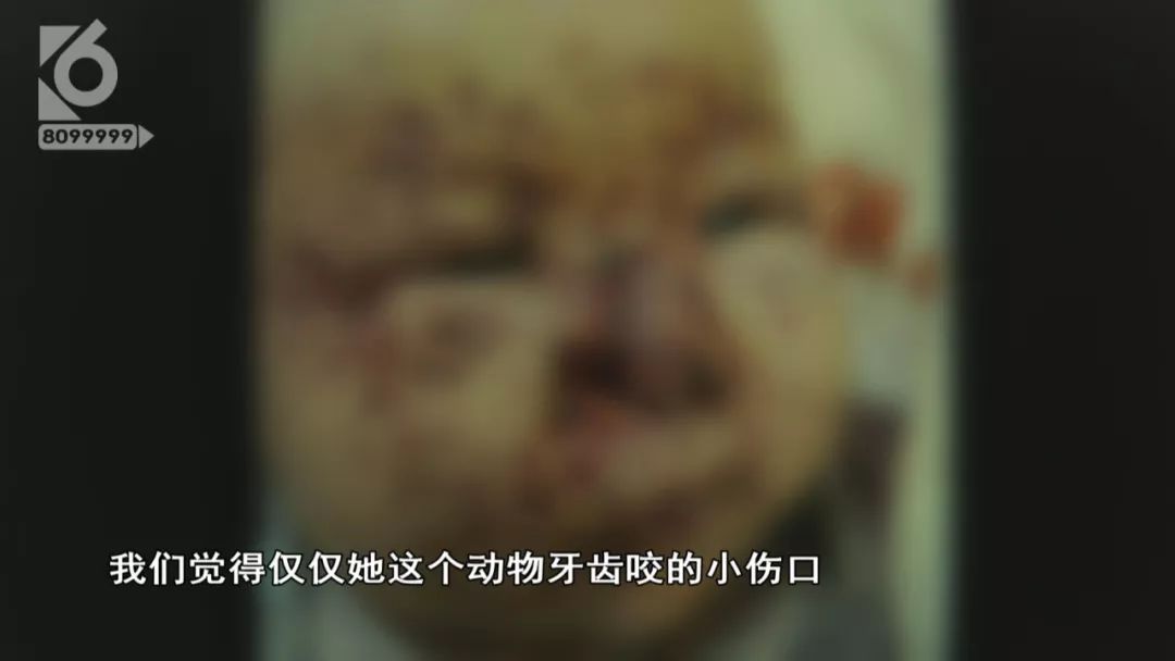 痛心百日女婴惨遭一窝老鼠啃食,三个月大的女婴被老鼠啃后续