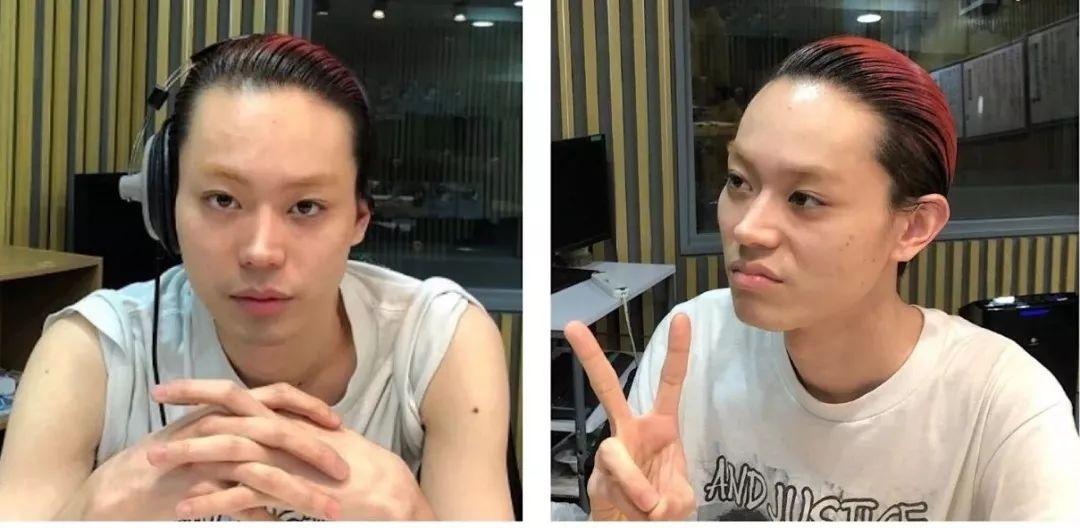 眉毛整容有几种方案,现在男生整容多吗