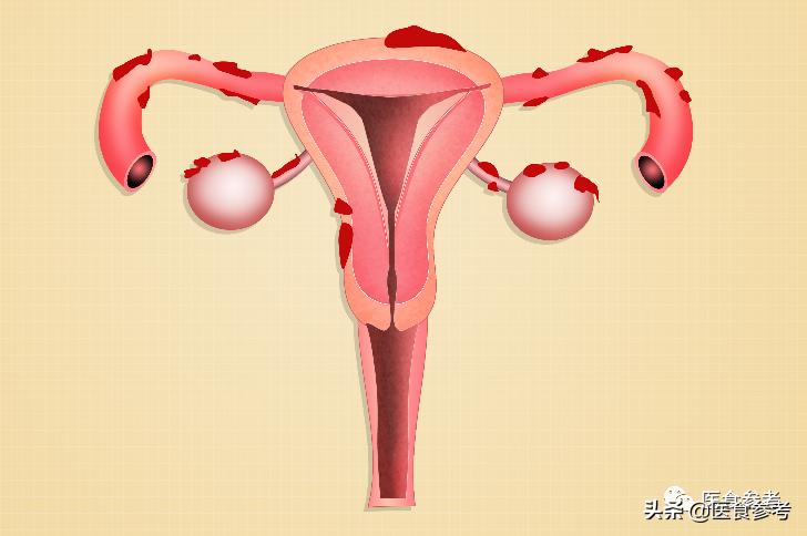 乳腺增生、卵巢囊肿、子宫肌瘤、泌尿系统感染，这些妇科病大多是被气出来的？