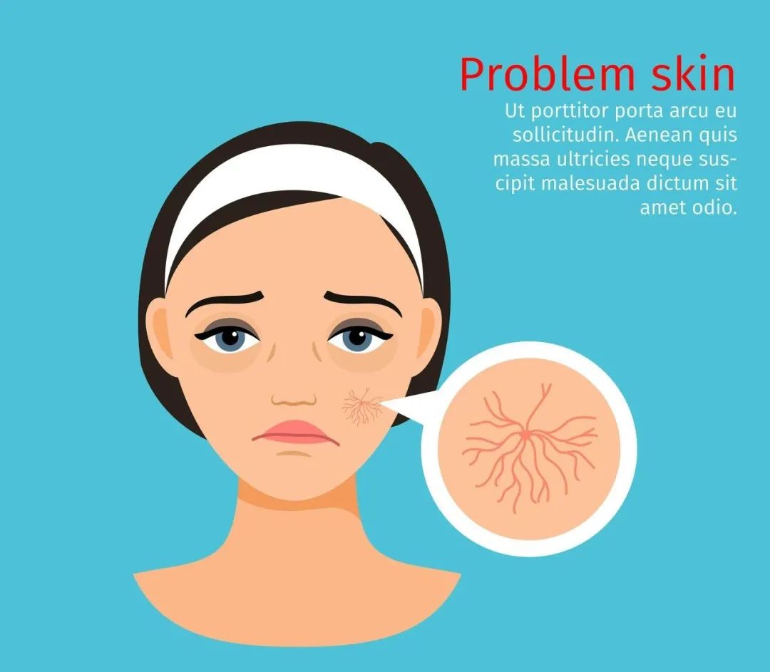 大学生挤痘痘引发的惨剧,女生挤痘痘导致面部感染