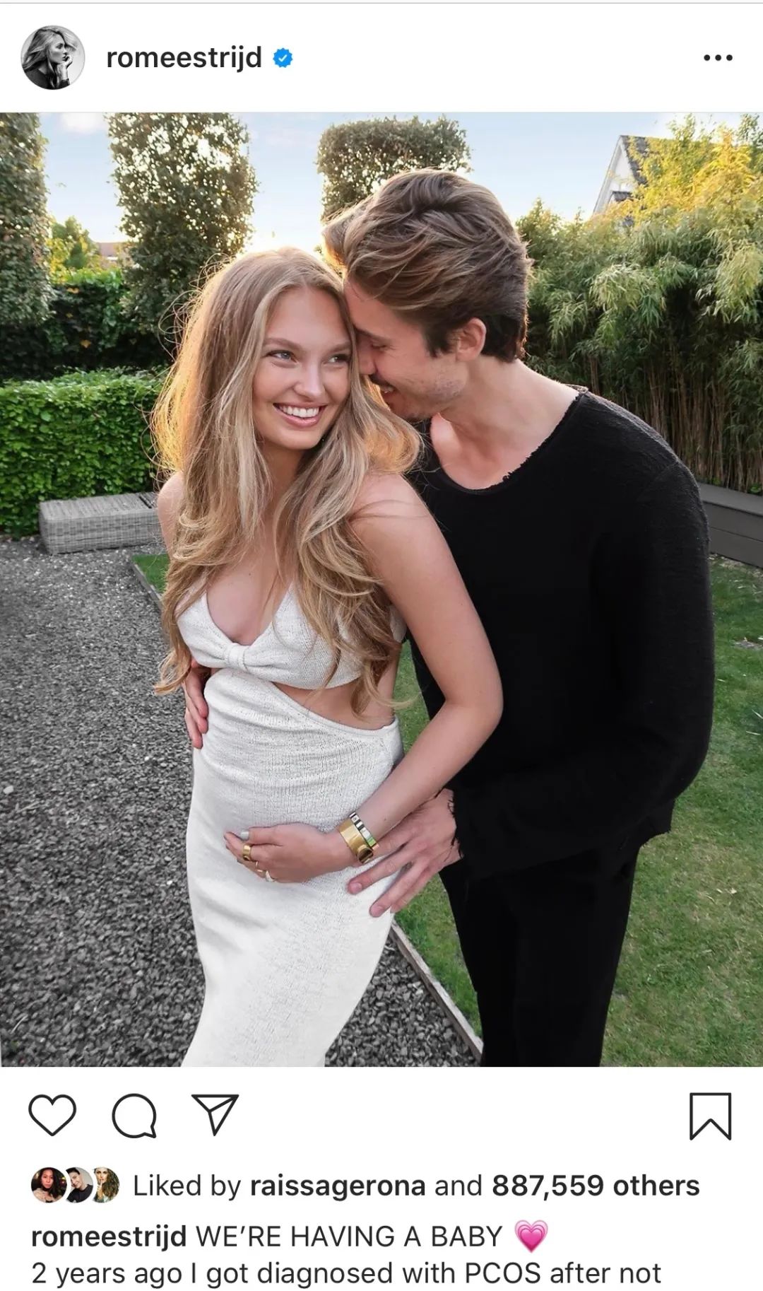 维秘超模七年不来月经！她们的“健康美”让无数效仿者身体垮掉