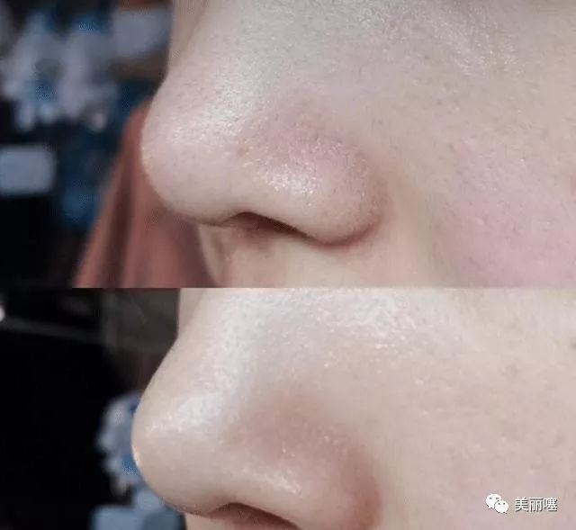 公认0差评的洗面奶,李佳琦:我用3年了,网友:仅7次黑头没了