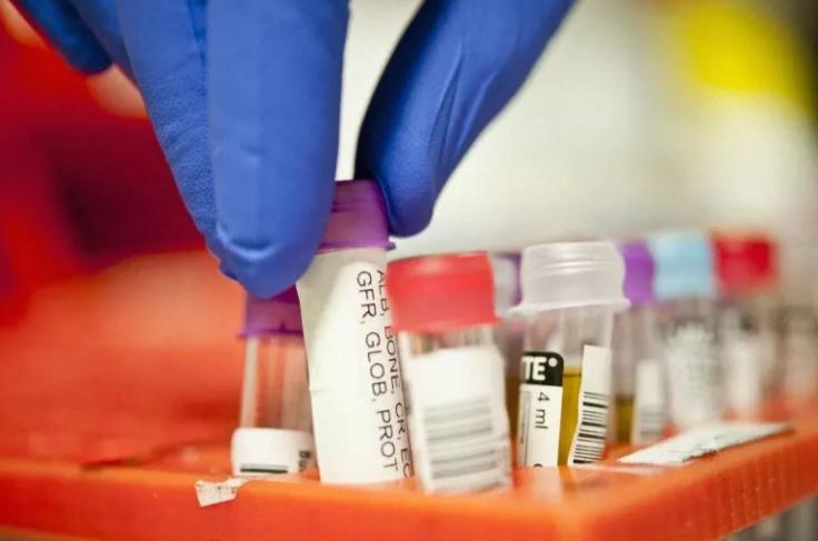 同型半胱氨酸高对心脑血管的影响,同型半胱氨酸高对血管内皮的危害