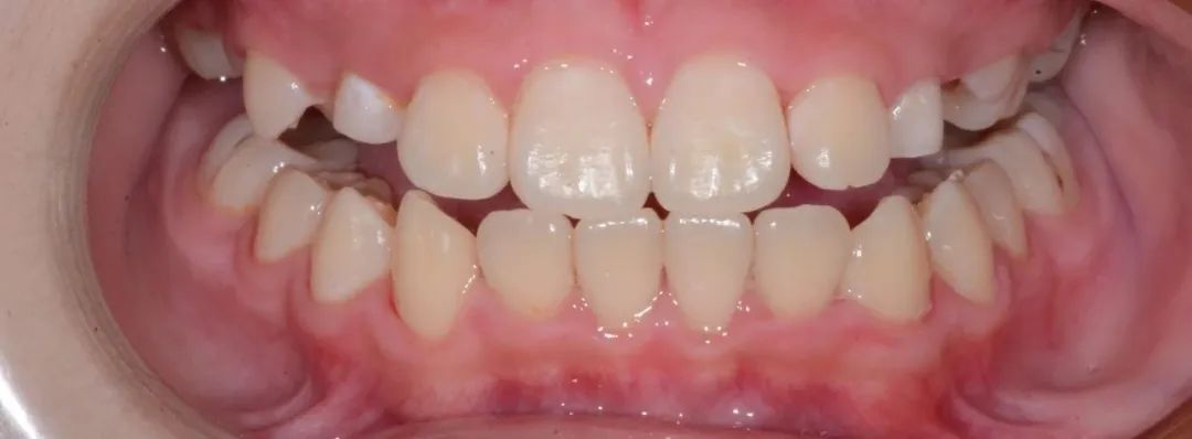 美白牙膏去牙黄真实有效测评,美白牙膏真实测评护牙效果