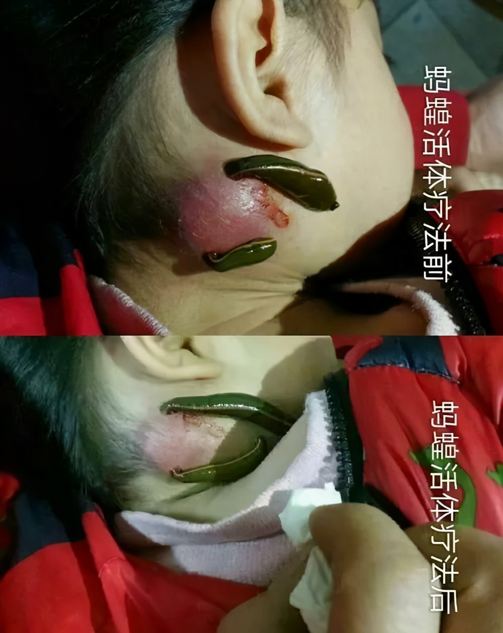 水蛭游到海里还能否活几天,水蛭切断了还能活吗还能长出来吗