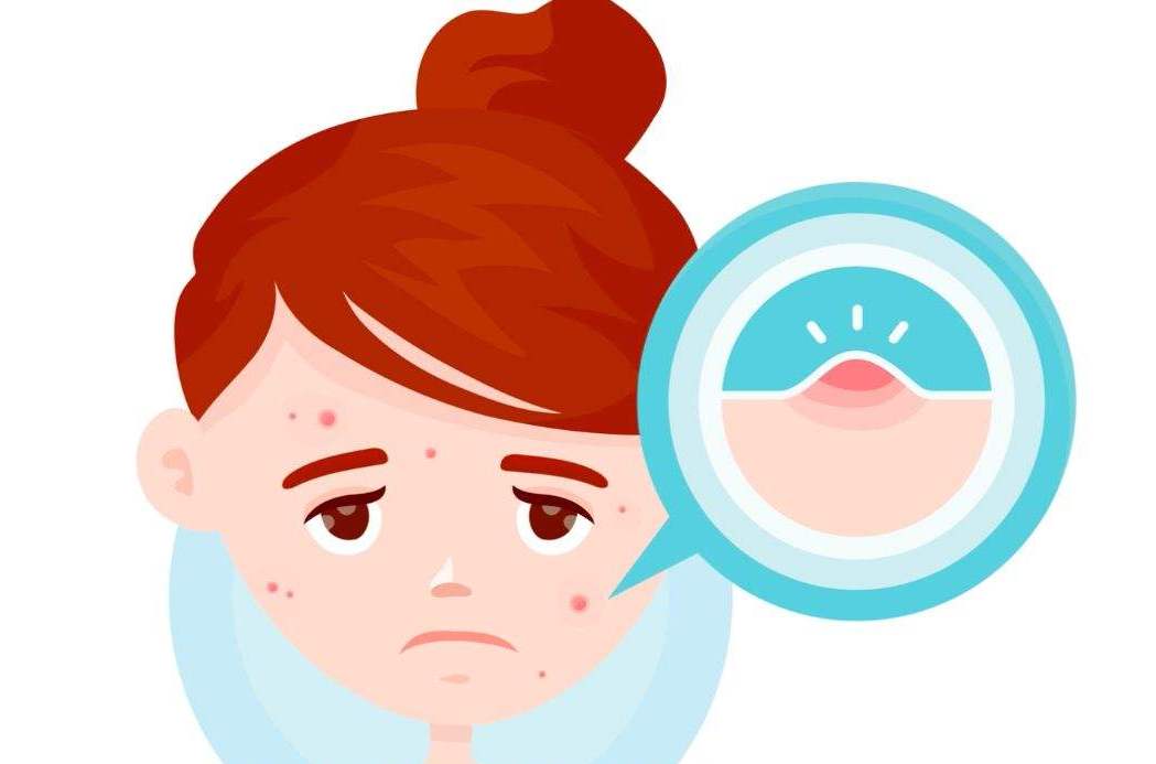 后背长了很多小米粒,后背长满小米粒的原因