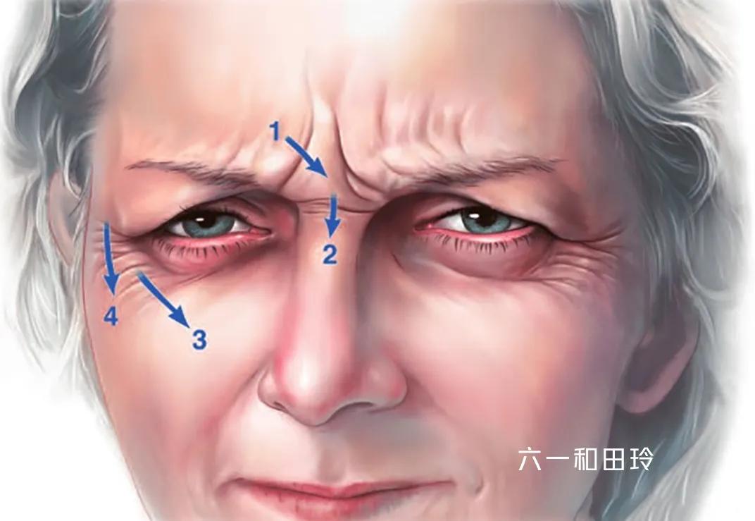 额头细纹皱纹怎么区别,额头上的细纹怎么解决