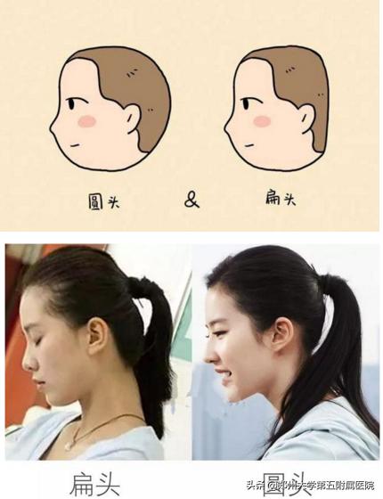 郑州大学五附院康复科怎么样,郑州大学五附院儿科