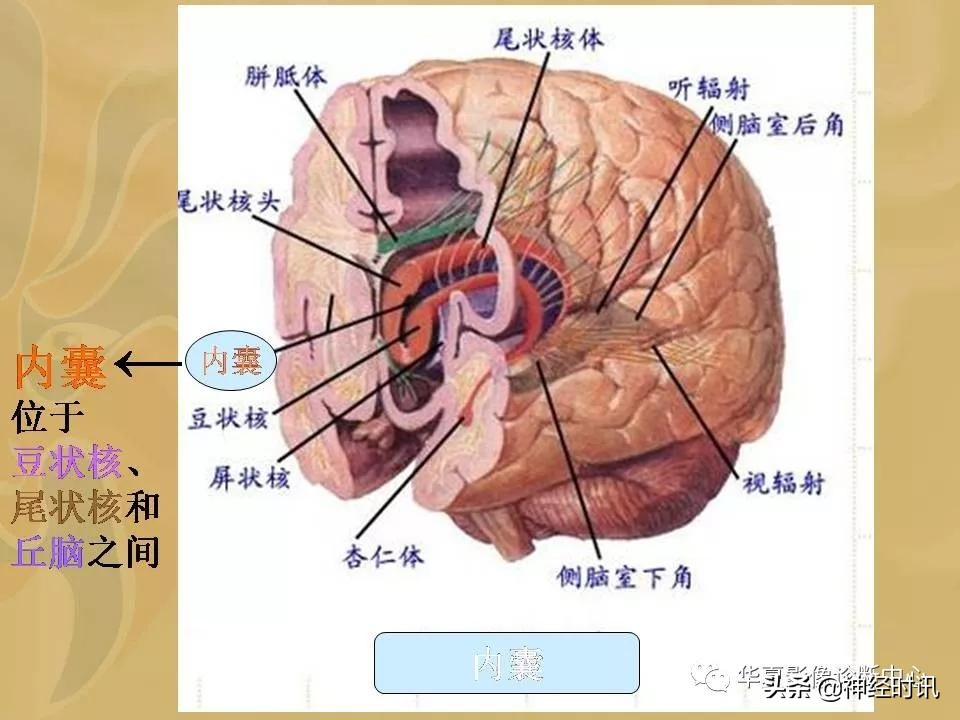 基底节ct解剖示意图,影像解剖图谱怎么用