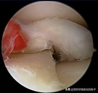 膝盖走路不怎么疼躺下就疼,儿童膝盖不动就不疼一走路就疼