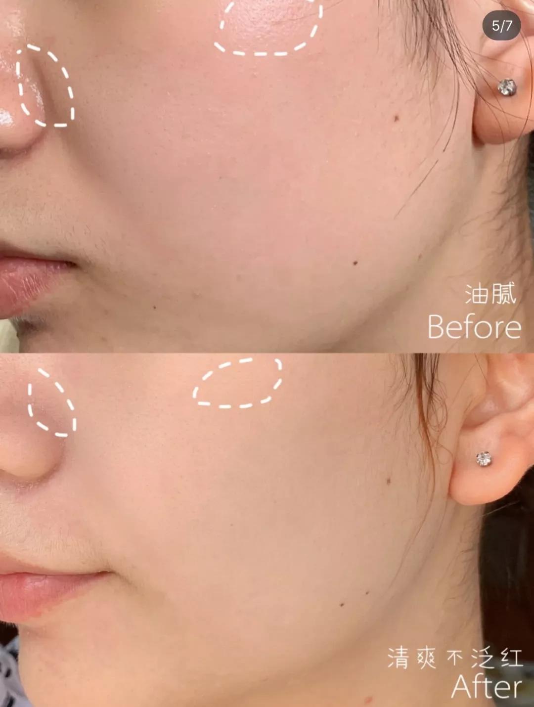 韩国超火品牌，明星都在安利，堪比CPB洗面奶！薛凯琪把它作为C位