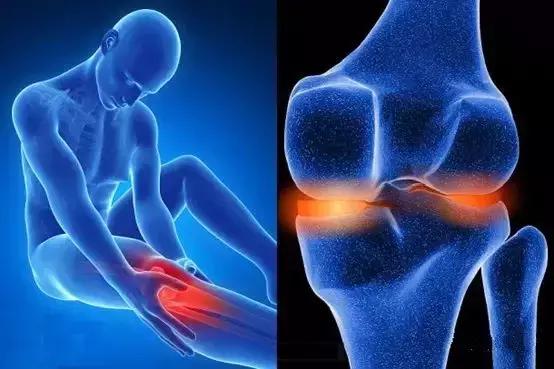 半月板自查方法,半月板最新诊疗指南