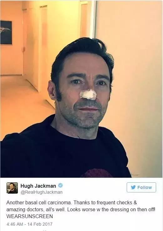 直男精致护肤的正确顺序,直男护肤必备