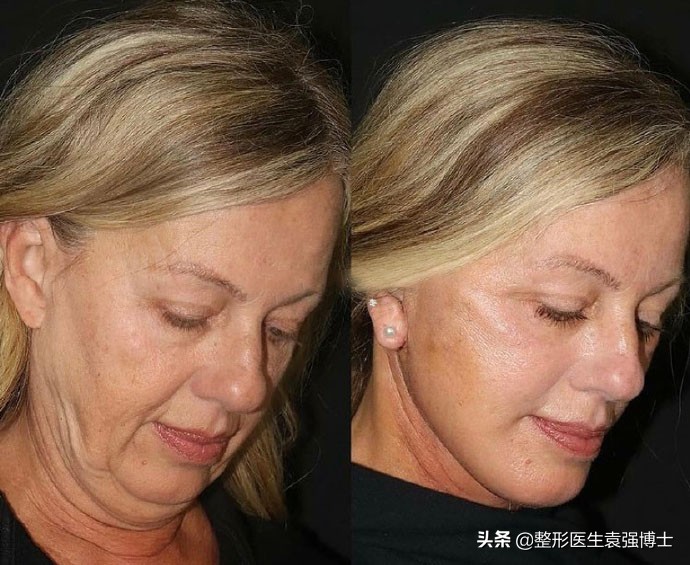 第一次做医美选择什么项目,第一次做医美项目如何选择