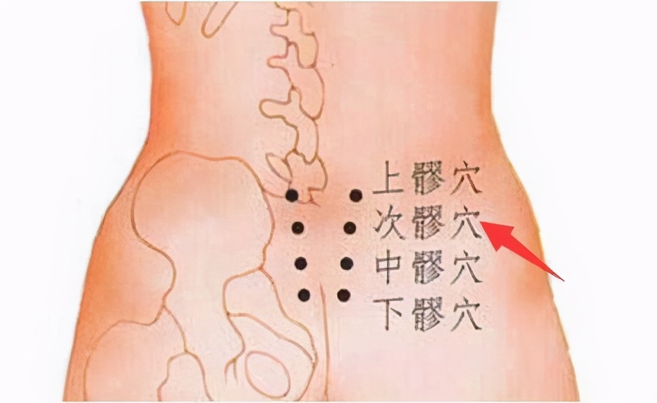 针刺次髎穴,针灸治疗巨髎穴疼痛