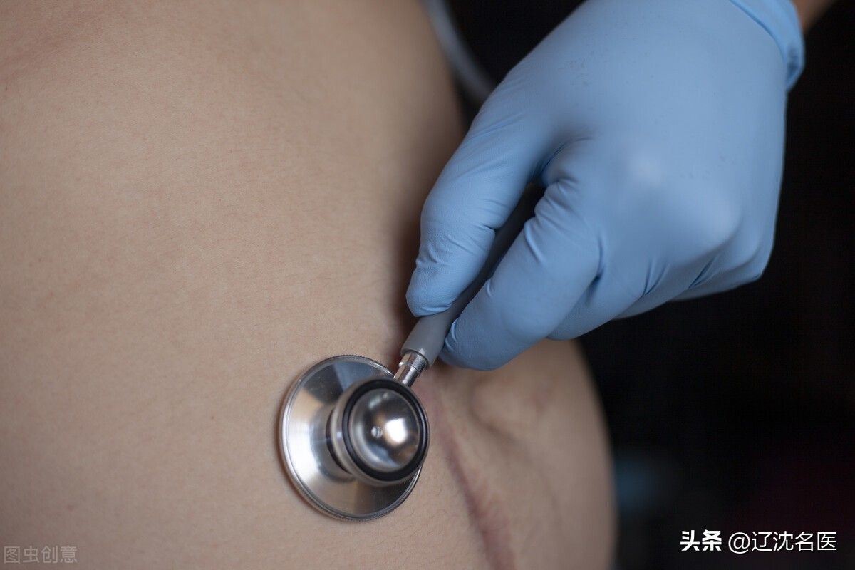 怕疼的话还是选择剖腹产,剖腹产4种疼痛方法