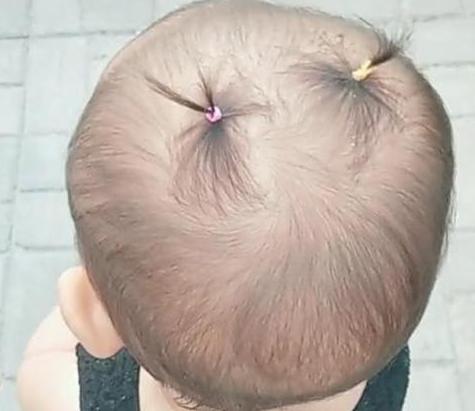 如何改变胎毛生长方向,怎么改变胎毛生长方向