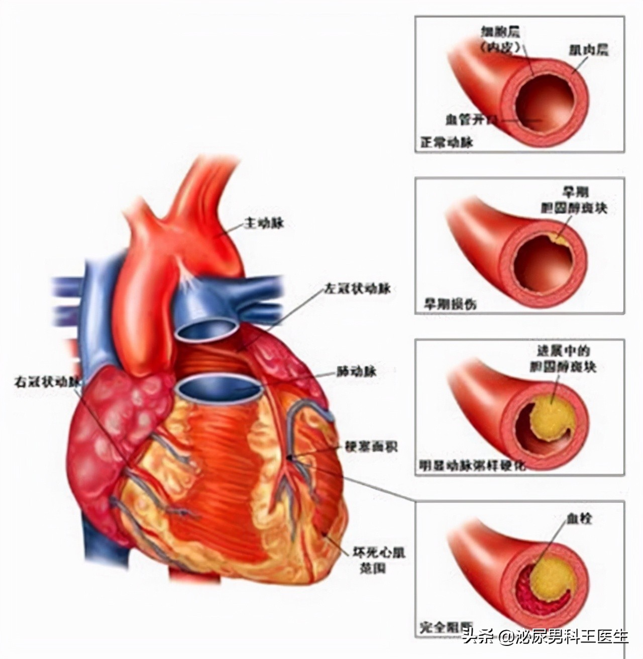 25岁前列腺增生是什么原因引起的,前列腺增生最好的治疗方法2020