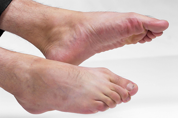 睡觉腿抽筋原因可能不仅仅是缺钙,睡觉突然腿抽筋并非是缺钙