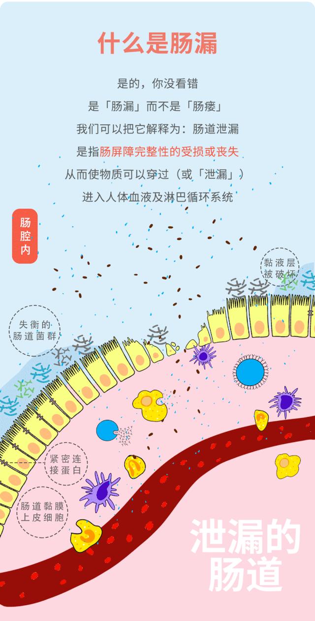 肠画短说：肠漏？它和我们的大多数疾病相关，现在了解还不晚