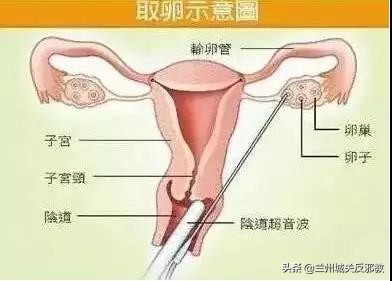 缃戜笂鎹愬嵉楠楀眬,鎹愬嵉楠楀眬鎶撴崟
