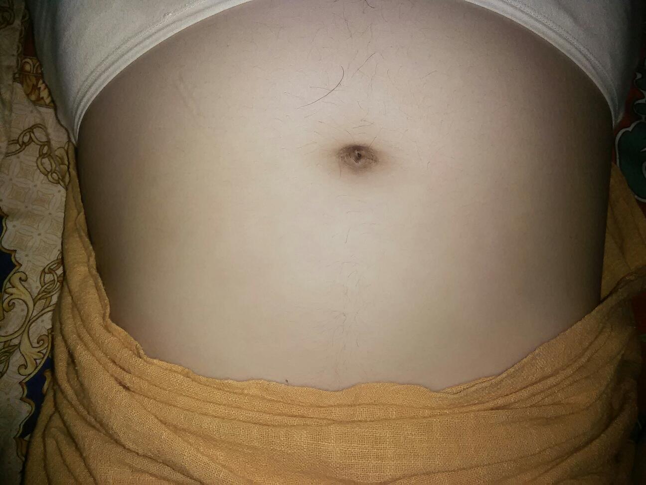 怀孕后肚子汗毛越来越重什么原因,怀孕肚子上长好多汗毛是怎么回事