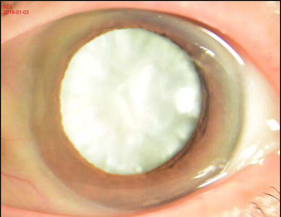 宁波奉化光明爱尔眼科医院,宁波市爱尔光明眼科医院