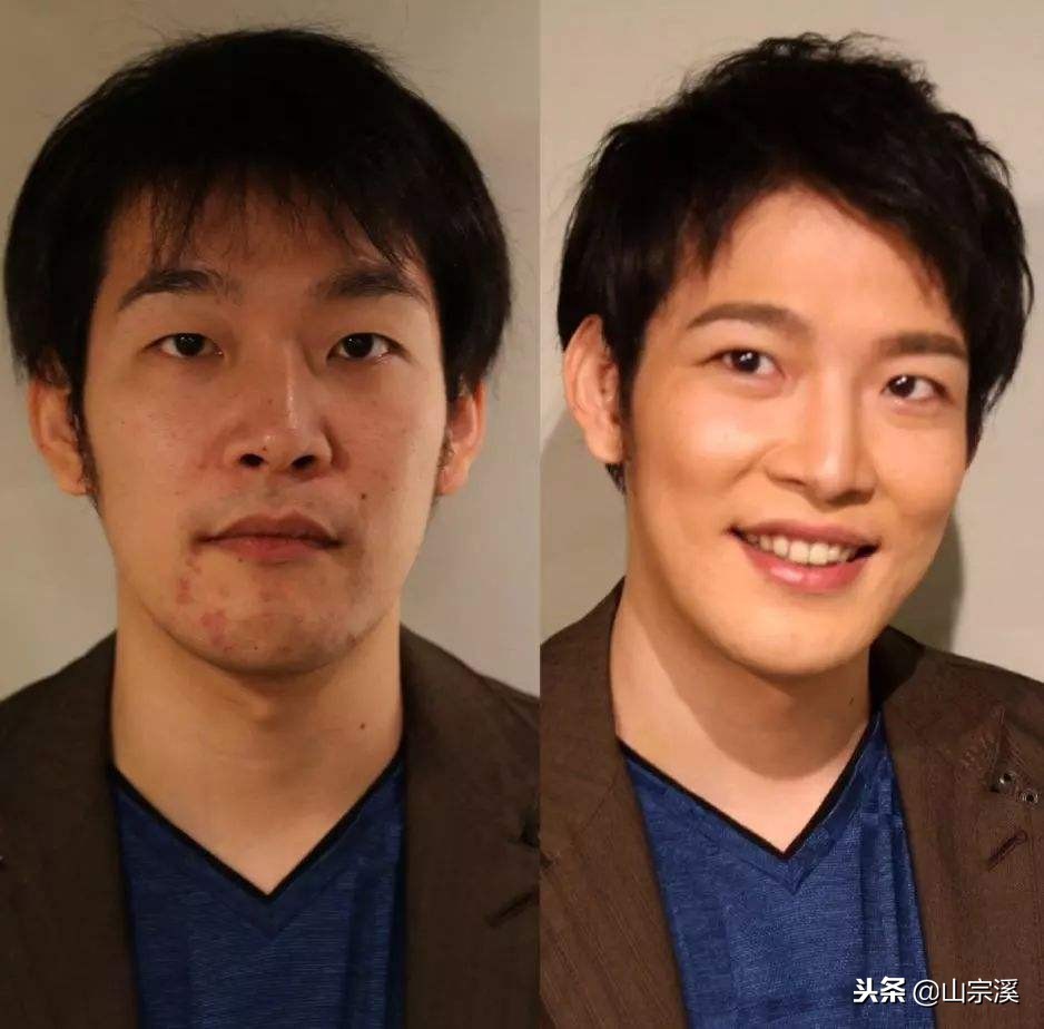 20+男生值得收藏的祛痘手册，关于痘痘，你不要只会用洗面奶洗