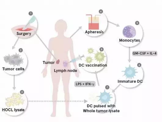 cns癌症免疫治疗的最新研究进展,全球免疫细胞治疗实体瘤发展现状