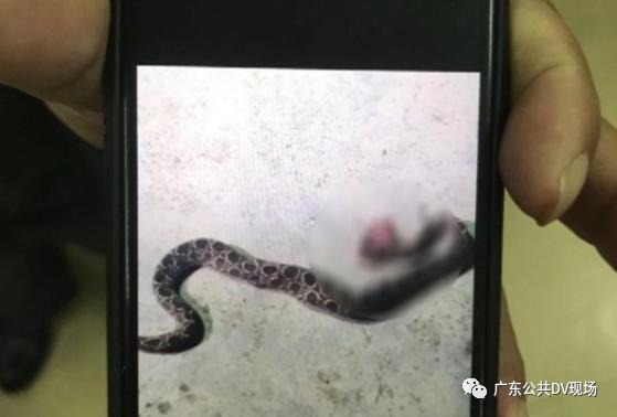 剧毒毒蛇咬伤小孩,要是毒蛇把孩子咬到了怎么处理