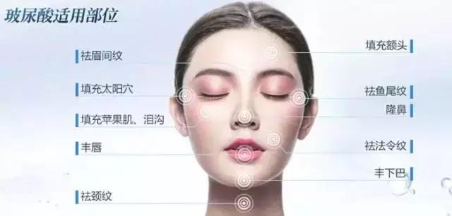 你知道什么是玻尿酸吗,如何快速了解玻尿酸品类