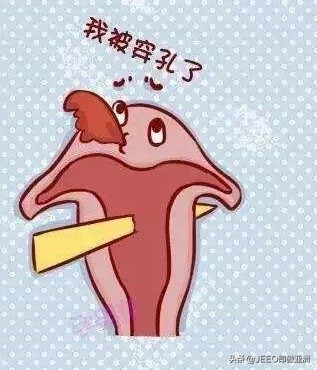 每日即傲——讲讲上环那些事