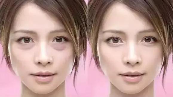 spatreatment紧致抗皱蛇毒眼膜,类蛇毒紧致修复眼膜