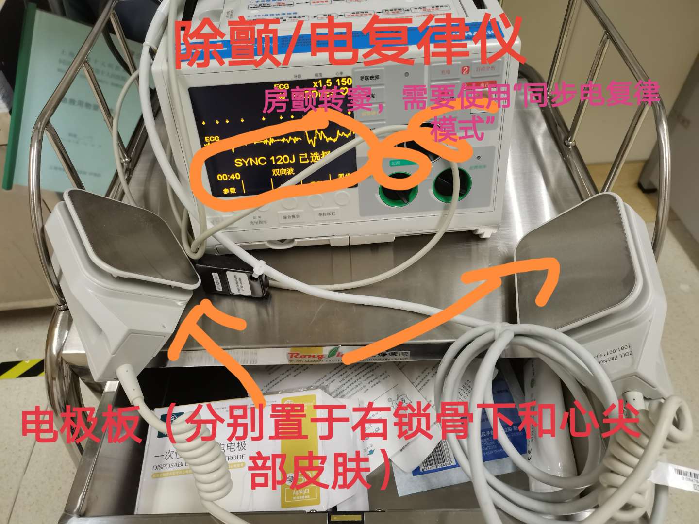 孕妇心动过速外加有点心肌缺血,怀孕心电图窦性心动过速心慌胸闷