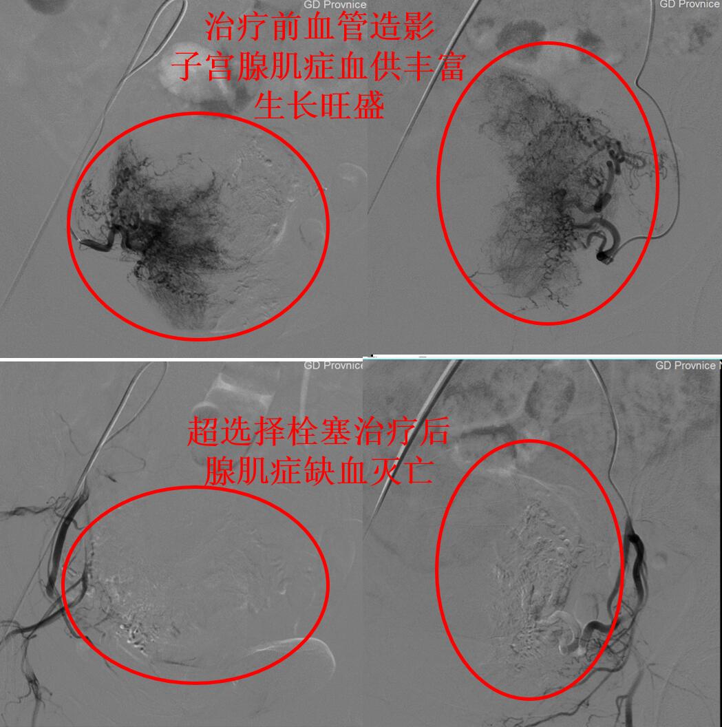 心脏做过手术需要常年吃药吗,心脏做过大手术后能干重活吗