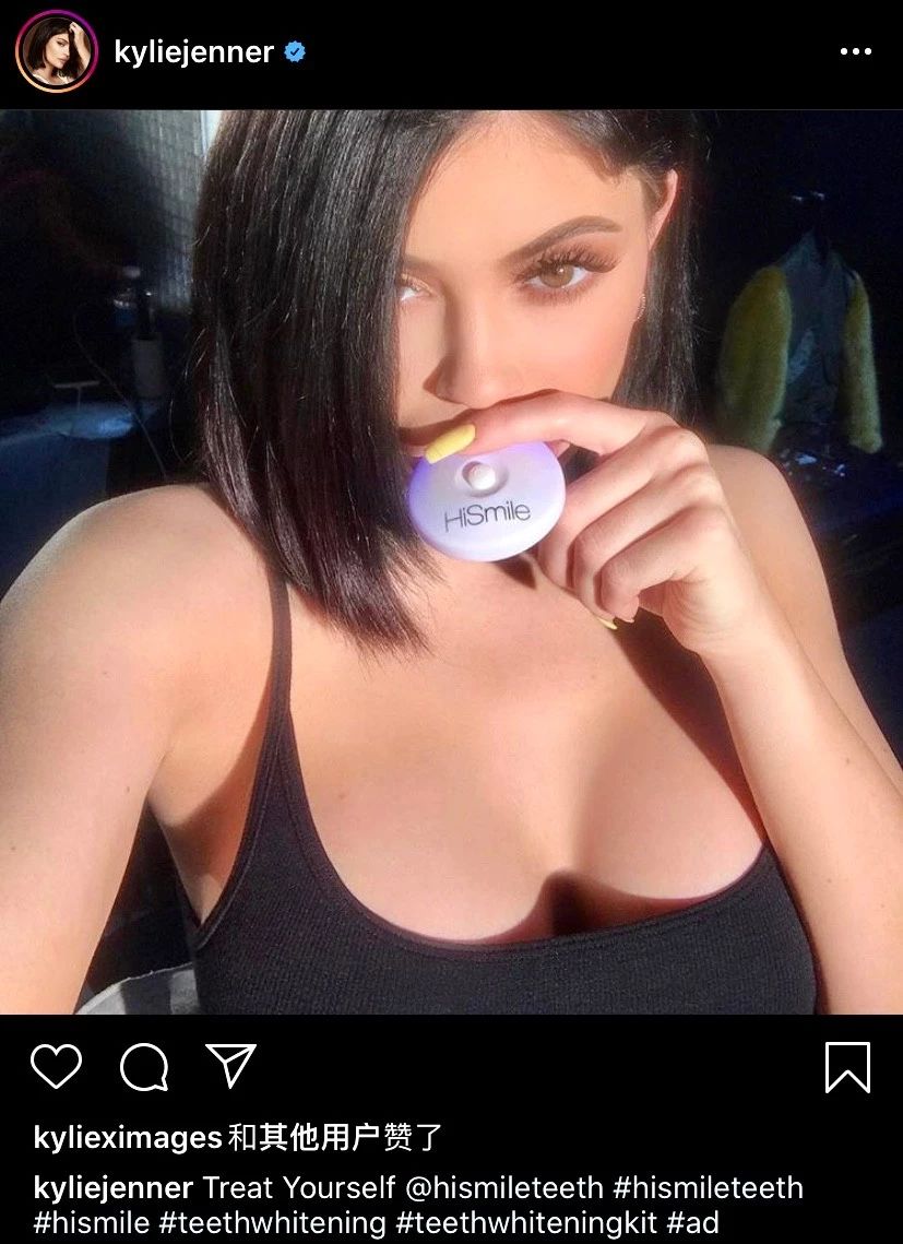 王鸥打瘦脸针真的假的,王鸥真的打过瘦脸针吗