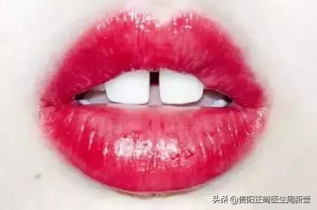 牙缝大吃东西总塞怎么办,牙缝太大了吃东西老是塞住怎么办