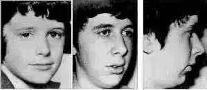 扁桃体容易发炎可以割掉吗,扁桃体老是发炎怎么彻底根治