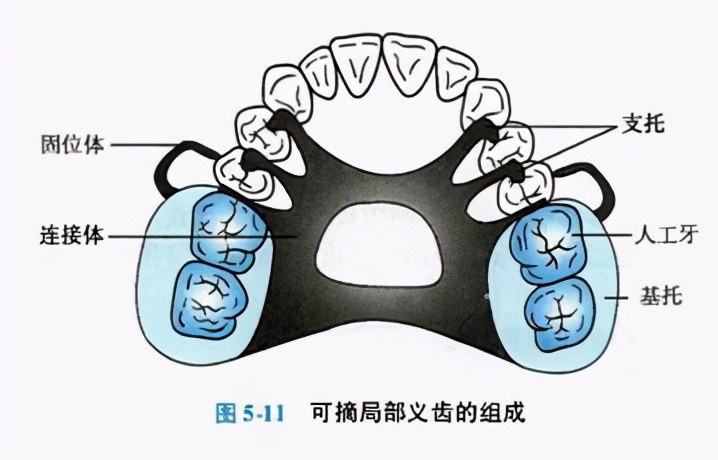 牙列缺损的可摘局部义齿修复题库,牙科美学修复精讲