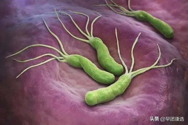 怀孕后查出幽门螺旋杆菌感染怎么办？对胎儿有没有影响？一文说清