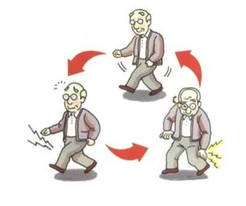 倒走锻炼有害吗,倒走有什么效果和坏处