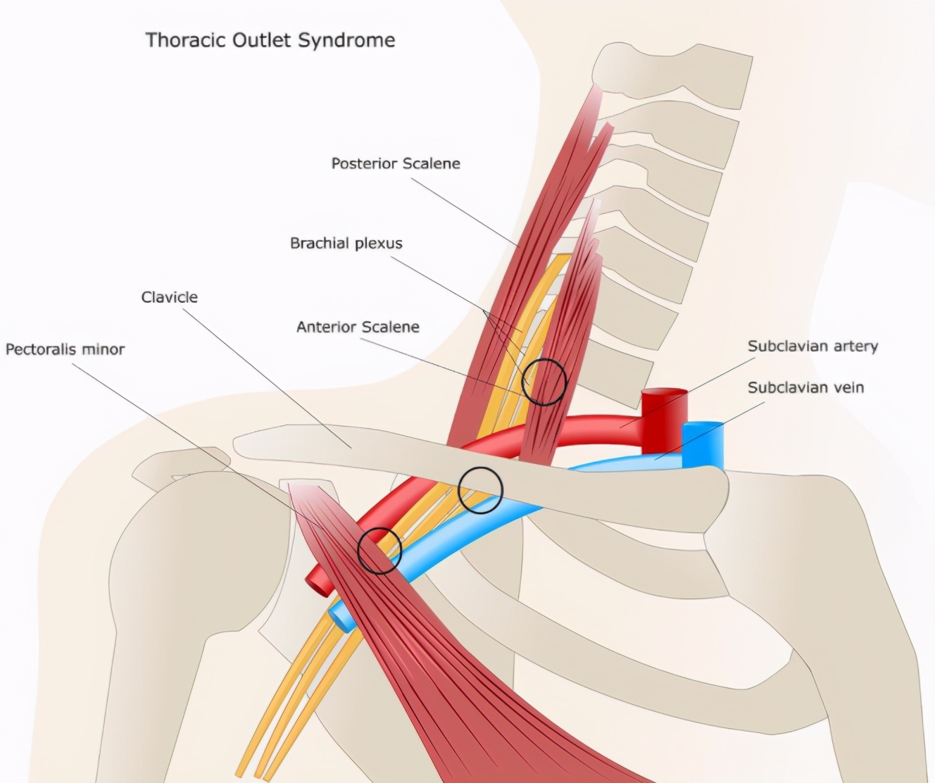 手麻是怎么造成的专家解说,手麻是什么病征兆怎么解决