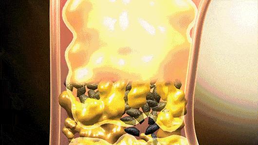 头发发质很蓬松而且很毛躁 (头发稀少不蓬松出油还厉害)