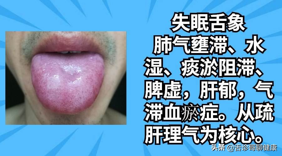 舌诊哥舌象分析视频,舌诊歌健康问答全集