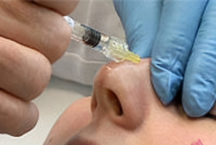 微整形用品,微整形黑幕大曝光