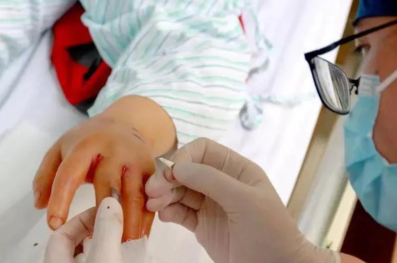 深圳毒蛇分布 (毒蛇高发地区)