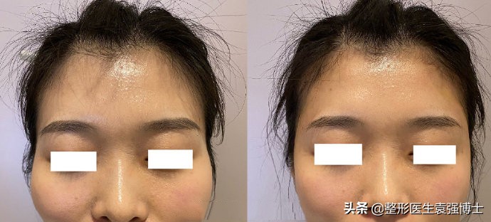 第一次做医美选择什么项目,第一次做医美项目如何选择