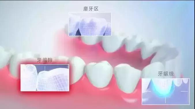 抖音上的美牙神器有用吗,使用美牙仪的抖音网红