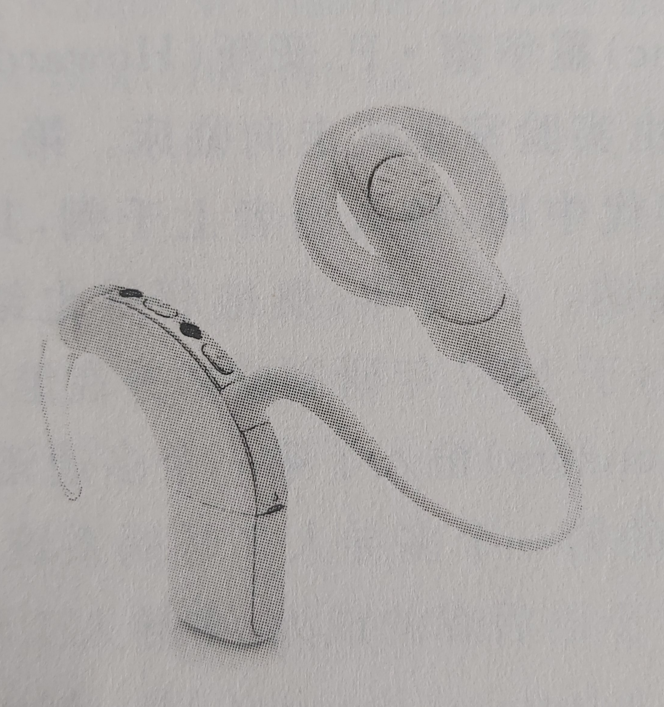 人工耳蜗第九代,双耳65分贝带助听器还是人工耳蜗